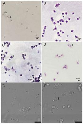 Morphologic, cytometric, quantitative transcriptomic and functional characterisation provide insights into the haemocyte immune responses of Pacific abalone (Haliotis discus hannai)